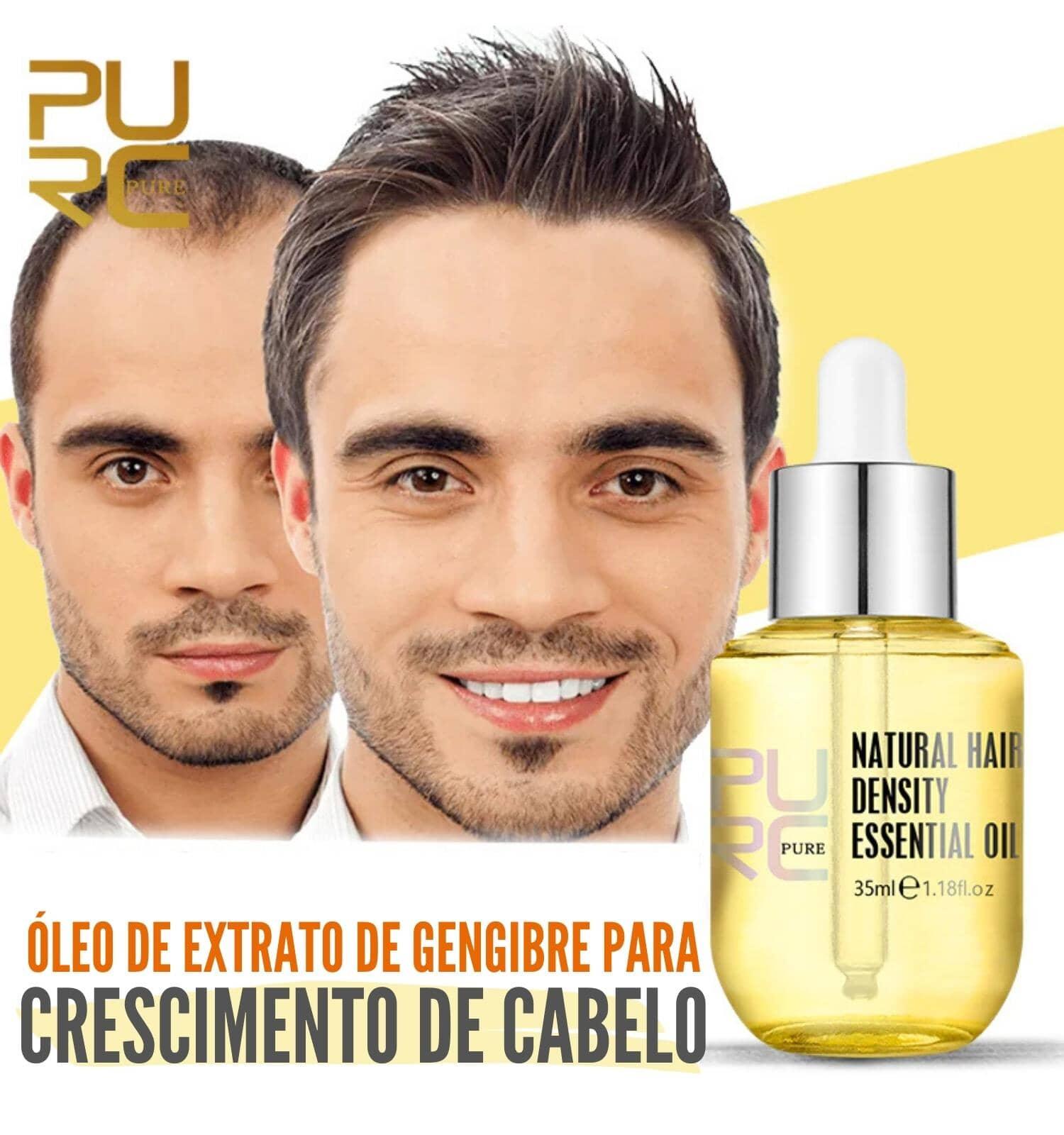 Óleo Natural para Queda de Cabelo - Pure Hair Óleo Queda de Cabelo - Saúde e Beleza 045 elefanteonline.com.br 